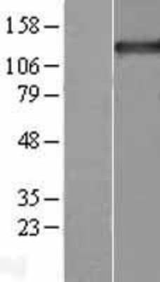 Western Blot: Tripeptidyl peptidase II Overexpression Lysate (Adult Normal) [NBL1-17224] Left-Empty vector transfected control cell lysate (HEK293 cell lysate); Right -Over-expression Lysate for Tripeptidyl peptidase II.