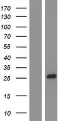 Western Blot: MS4A4A Overexpression Lysate (Adult Normal) [NBP2-09914] Left-Empty vector transfected control cell lysate (HEK293 cell lysate); Right -Over-expression Lysate for MS4A4A.