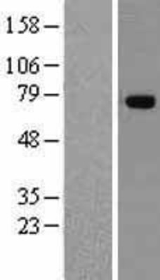 Western Blot: TNIP1 Overexpression Lysate (Adult Normal) [NBL1-17172] Left-Empty vector transfected control cell lysate (HEK293 cell lysate); Right -Over-expression Lysate for TNIP1.