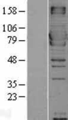 Western Blot: MX1 Overexpression Lysate (Adult Normal) [NBL1-13404] Left-Empty vector transfected control cell lysate (HEK293 cell lysate); Right -Over-expression Lysate for MX1.