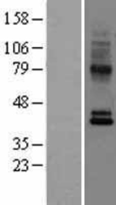 Western Blot: GPR2/CCR10 Overexpression Lysate (Adult Normal) [NBL1-08888] Left-Empty vector transfected control cell lysate (HEK293 cell lysate); Right -Over-expression Lysate for GPR2/CCR10.