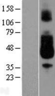 Western Blot: CD89 Overexpression Lysate (Adult Normal) [NBL1-10649] Left-Empty vector transfected control cell lysate (HEK293 cell lysate); Right -Over-expression Lysate for CD89.