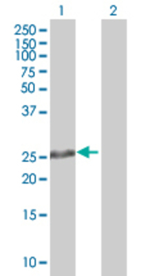 Lane 1: MS4A8B transfected lysate (27.61 KDa). Lane 2: Non-transfected lysate.
