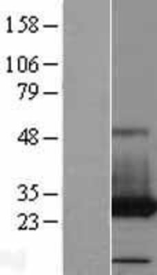 Western Blot: PAFAH1B3 Overexpression Lysate (Adult Normal) [NBP2-09769] Left-Empty vector transfected control cell lysate (HEK293 cell lysate); Right -Over-expression Lysate for PAFAH1B3.