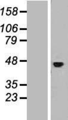 Western Blot: IL11RA Overexpression Lysate (Adult Normal) [NBP2-09671] Left-Empty vector transfected control cell lysate (HEK293 cell lysate); Right -Over-expression Lysate for IL11RA.