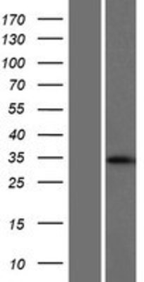 Western Blot: BCAP31 Overexpression Lysate (Adult Normal) [NBP2-09619] Left-Empty vector transfected control cell lysate (HEK293 cell lysate); Right -Over-expression Lysate for BCAP31.