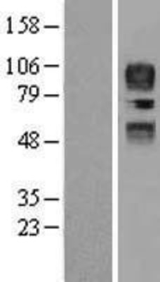 Western Blot: CD34 Overexpression Lysate (Adult Normal) [NBP2-09777] Left-Empty vector transfected control cell lysate (HEK293 cell lysate); Right -Over-expression Lysate for CD34.