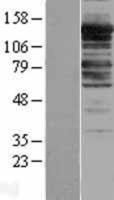 Western Blot: Myosin Phosphatase Overexpression Lysate (Adult Normal) [NBL1-14674] Left-Empty vector transfected control cell lysate (HEK293 cell lysate); Right -Over-expression Lysate for Myosin Phosphatase.
