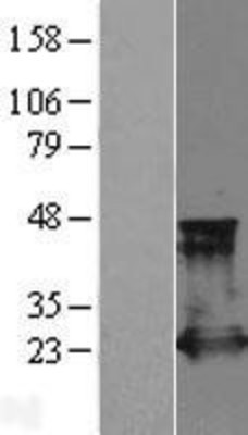 Western Blot: Rap2A Overexpression Lysate (Adult Normal) [NBL1-15148] Left-Empty vector transfected control cell lysate (HEK293 cell lysate); Right -Over-expression Lysate for Rap2A.