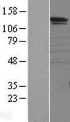 Western Blot: SorCS1 Overexpression Lysate (Adult Normal) [NBL1-16338] Left-Empty vector transfected control cell lysate (HEK293 cell lysate); Right -Over-expression Lysate for SorCS1.