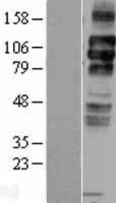 Western Blot: LDL Receptor Overexpression Lysate (Adult Normal) [NBL1-12475] Left-Empty vector transfected control cell lysate (HEK293 cell lysate); Right -Over-expression Lysate for LDL Receptor.