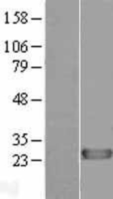 Western Blot: DIRAS1 Overexpression Lysate (Adult Normal) [NBL1-09889] Left-Empty vector transfected control cell lysate (HEK293 cell lysate); Right -Over-expression Lysate for DIRAS1.