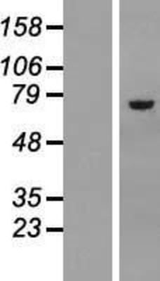 Western Blot: Asparagine synthetase Overexpression Lysate (Adult Normal) [NBL1-07770] Left-Empty vector transfected control cell lysate (HEK293 cell lysate); Right -Over-expression Lysate for Asparagine synthetase.