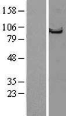 Western Blot: Striatin Overexpression Lysate (Adult Normal) [NBL1-16570] Left-Empty vector transfected control cell lysate (HEK293 cell lysate); Right -Over-expression Lysate for Striatin.