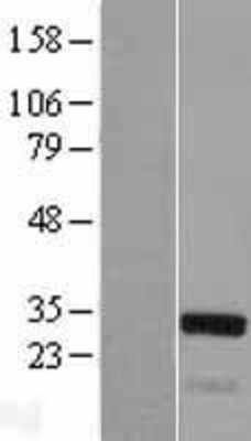 Western Blot: TGF beta induced factor 2 Overexpression Lysate (Adult Normal) [NBL1-16864] Left-Empty vector transfected control cell lysate (HEK293 cell lysate); Right -Over-expression Lysate for TGF beta induced factor 2.