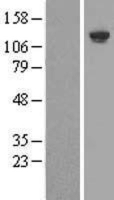 Western Blot: SHIP Overexpression Lysate (Adult Normal) [NBL1-12000] Left-Empty vector transfected control cell lysate (HEK293 cell lysate); Right -Over-expression Lysate for SHIP.