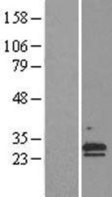 Western Blot: NR6 Overexpression Lysate (Adult Normal) [NBL1-09231] Left-Empty vector transfected control cell lysate (HEK293 cell lysate); Right -Over-expression Lysate for NR6.