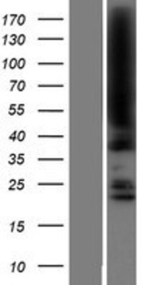 Western Blot: JMJD5 Overexpression Lysate (Adult Normal) [NBP2-09744] Left-Empty vector transfected control cell lysate (HEK293 cell lysate); Right -Over-expression Lysate for JMJD5.