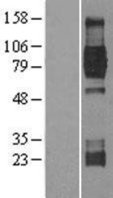 Western Blot: TrkB Overexpression Lysate (Adult Normal) [NBL1-13836] Left-Empty vector transfected control cell lysate (HEK293 cell lysate); Right -Over-expression Lysate for TrkB.