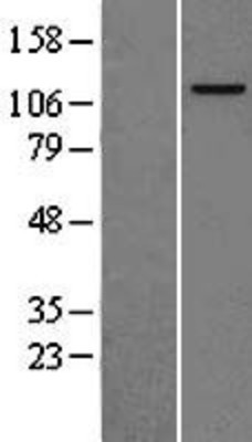 Western Blot: MCM2 Overexpression Lysate (Adult Normal) [NBL1-12950] Left-Empty vector transfected control cell lysate (HEK293 cell lysate); Right -Over-expression Lysate for MCM2.