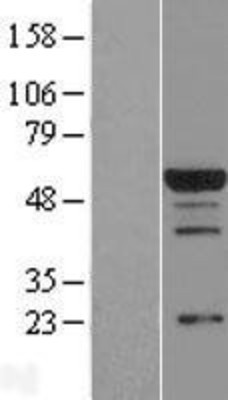 Western Blot: RBPJK Overexpression Lysate (Adult Normal) [NBL1-15233] Left-Empty vector transfected control cell lysate (HEK293 cell lysate); Right -Over-expression Lysate for RBPJK.