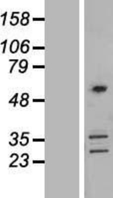Western Blot: Coronin-2B Overexpression Lysate (Adult Normal) [NBL1-09401] Left-Empty vector transfected control cell lysate (HEK293 cell lysate); Right -Over-expression Lysate for Coronin-2B.