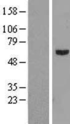 Western Blot: SMOX Overexpression Lysate (Adult Normal) [NBL1-16249] Left-Empty vector transfected control cell lysate (HEK293 cell lysate); Right -Over-expression Lysate for SMOX.