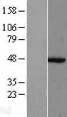 Western Blot: ACTR2 Overexpression Lysate (Adult Normal) [NBL1-07287] Left-Empty vector transfected control cell lysate (HEK293 cell lysate); Right -Over-expression Lysate for ACTR2.