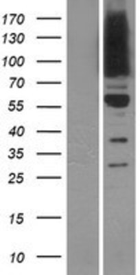 Western Blot: OSBPL9 Overexpression Lysate (Adult Normal) [NBP2-09997] Left-Empty vector transfected control cell lysate (HEK293 cell lysate); Right -Over-expression Lysate for OSBPL9.
