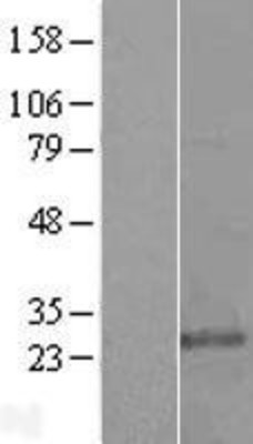 Western Blot: KDELR3 Overexpression Lysate (Adult Normal) [NBL1-12222] Left-Empty vector transfected control cell lysate (HEK293 cell lysate); Right -Over-expression Lysate for KDELR3.