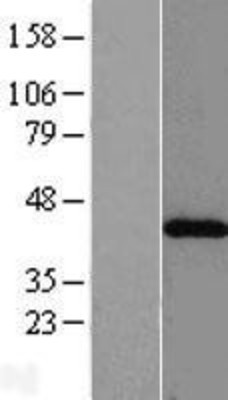 Western Blot: ACAT2 Overexpression Lysate (Adult Normal) [NBL1-07225] Left-Empty vector transfected control cell lysate (HEK293 cell lysate); Right -Over-expression Lysate for ACAT2.