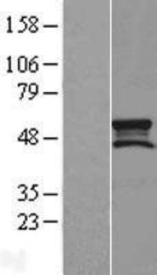 Western Blot: SMCR7L Overexpression Lysate (Adult Normal) [NBL1-16240] Left-Empty vector transfected control cell lysate (HEK293 cell lysate); Right -Over-expression Lysate for SMCR7L.