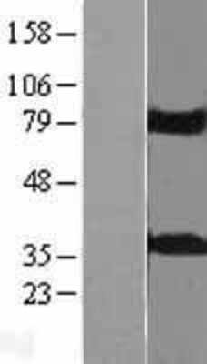 Western Blot: KCTD10 Overexpression Lysate (Adult Normal) [NBL1-12207] Left-Empty vector transfected control cell lysate (HEK293 cell lysate); Right -Over-expression Lysate for KCTD10.