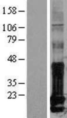 Western Blot: Id1 Overexpression Lysate (Adult Normal) [NBL1-11813] Left-Empty vector transfected control cell lysate (HEK293 cell lysate); Right -Over-expression Lysate for Id1.