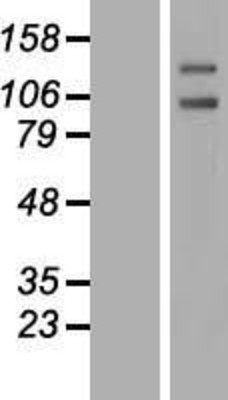Western Blot: PTP alpha Overexpression Lysate (Adult Normal) [NBL1-14980] Left-Empty vector transfected control cell lysate (HEK293 cell lysate); Right -Over-expression Lysate for PTP alpha.