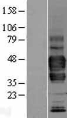 Western Blot: LYVE1 Overexpression Lysate (Adult Normal) [NBL1-12770] Left-Empty vector transfected control cell lysate (HEK293 cell lysate); Right -Over-expression Lysate for LYVE1.