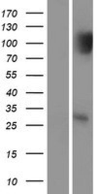 Western Blot: p53 DINP1 Overexpression Lysate (Adult Normal) [NBP2-05894] Left-Empty vector transfected control cell lysate (HEK293 cell lysate); Right -Over-expression Lysate for p53 DINP1.