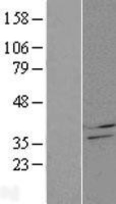Western Blot: CBR4 Overexpression Lysate (Adult Normal) [NBP2-05968] Left-Empty vector transfected control cell lysate (HEK293 cell lysate); Right -Over-expression Lysate for CBR4.