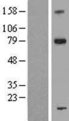 Western Blot: FAM161A Overexpression Lysate (Adult Normal) [NBP2-06066] Left-Empty vector transfected control cell lysate (HEK293 cell lysate); Right -Over-expression Lysate for FAM161A.