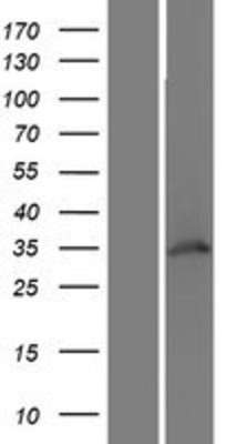 Western Blot: WDR82 Overexpression Lysate (Adult Normal) [NBP2-06206] Left-Empty vector transfected control cell lysate (HEK293 cell lysate); Right -Over-expression Lysate for WDR82.