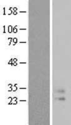 Western Blot: IL9 Overexpression Lysate (Adult Normal) [NBL1-11970] Left-Empty vector transfected control cell lysate (HEK293 cell lysate); Right -Over-expression Lysate for IL9.