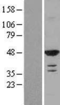 Western Blot: RASSF8 Overexpression Lysate (Adult Normal) [NBL1-15180] Left-Empty vector transfected control cell lysate (HEK293 cell lysate); Right -Over-expression Lysate for RASSF8.