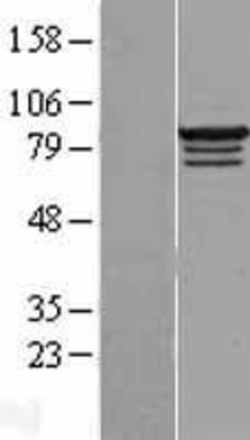 Western Blot: RBM28 Overexpression Lysate (Adult Normal) [NBL1-15204] Left-Empty vector transfected control cell lysate (HEK293 cell lysate); Right -Over-expression Lysate for RBM28.
