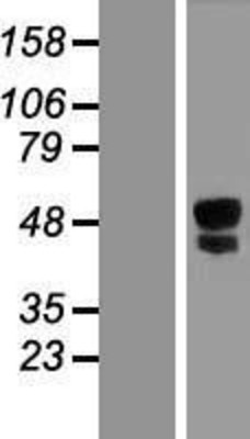 Western Blot: ITPRIPL1 Overexpression Lysate (Adult Normal) [NBL1-12279] Left-Empty vector transfected control cell lysate (HEK293 cell lysate); Right -Over-expression Lysate for ITPRIPL1.