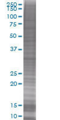 MYOZ2 transfected lysate
