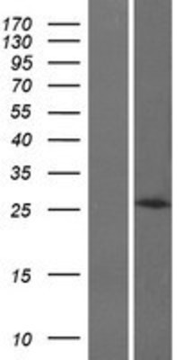 Western Blot: HOXB8 Overexpression Lysate (Adult Normal) [NBP2-06361] Left-Empty vector transfected control cell lysate (HEK293 cell lysate); Right -Over-expression Lysate for HOXB8.