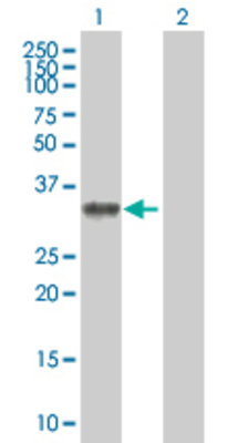 Lane 1: MYOZ2 transfected lysate (29.15 KDa). Lane 2: Non-transfected lysate.