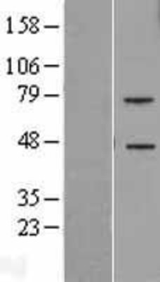 Western Blot: TREML2 Overexpression Lysate (Adult Normal) [NBP2-06287] Left-Empty vector transfected control cell lysate (HEK293 cell lysate); Right -Over-expression Lysate for TREML2.