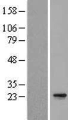 Western Blot: C15orf24 Overexpression Lysate (Adult Normal) [NBL1-08201] Left-Empty vector transfected control cell lysate (HEK293 cell lysate); Right -Over-expression Lysate for C15orf24.