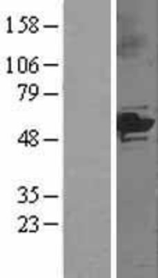 Western Blot: Cytochrome P450 3A5 Overexpression Lysate (Adult Normal) [NBL1-09693] Left-Empty vector transfected control cell lysate (HEK293 cell lysate); Right -Over-expression Lysate for Cytochrome P450 3A5.